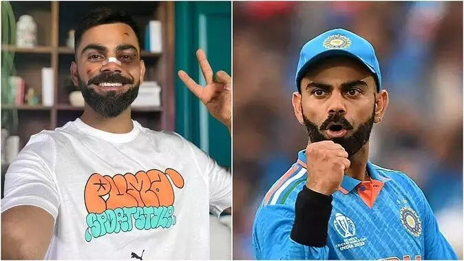 Virat Kohli: सूजी हुई आंख, नाक पर पट्टी और चोट के निशान; विराट कोहली को देख डर गए फैंस, पूछा- सब ठीक है?