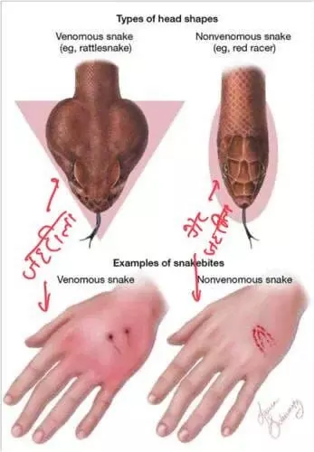 सांप काट ले तो तुरंत में कैसे करें उपचार, इन गलतियों से बचें